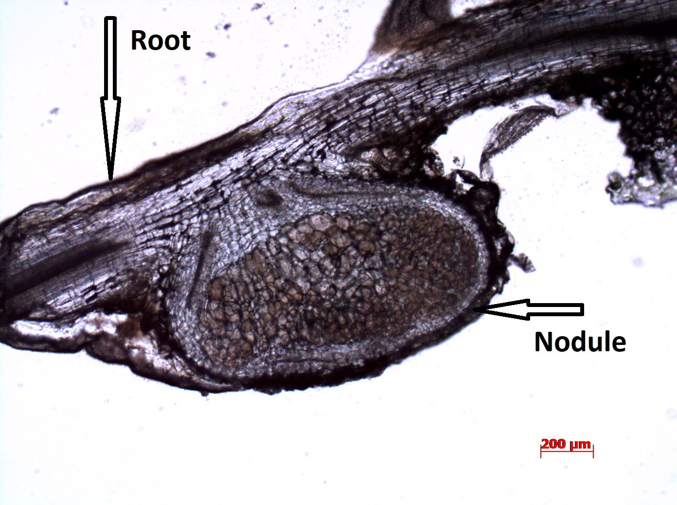 Nodule under light microscope